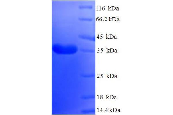 DYDC2 Protein (AA 1-177, full length) (His-SUMO Tag)