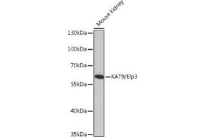 Western blot analysis of extracts of Mouse kidney, using K/K/Elp3 antibody (ABIN6130883, ABIN6140142, ABIN6140143 and ABIN6225217) at 1:1000 dilution. (ELP3/KAT9 anticorps  (AA 358-547))