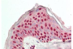 Rabbit Anti-GRHL2 antibody  Formalin Fixed Paraffin Embedded Tissue: Human Skin Primary antibody Concentration: 1:200 Secondary Antibody: Donkey anti-Rabbit-Cy3 Secondary Antibody Concentration: 1:200 Magnification: 20x Exposure Time: 0.