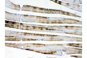 IHC testing of FFPE rat skeletal muscle with ACTN3 antibody at 1ug/ml.