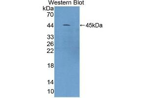 Western blot analysis of the recombinant protein. (CAMK1 anticorps  (AA 1-370))