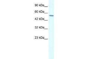WB Suggested Anti-RGS6 Antibody Titration:  0. (RGS6 anticorps  (C-Term))