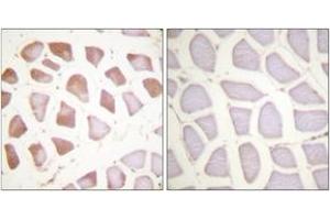 Immunohistochemistry analysis of paraffin-embedded human skeletal muscle tissue, using TNNI3 (Ab-142) Antibody.