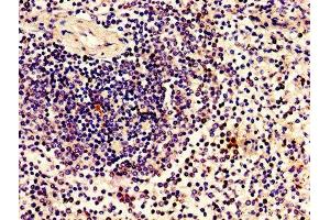 Immunohistochemistry of paraffin-embedded human spleen tissue using ABIN7165052 at dilution of 1:100 (ZBTB8OS anticorps  (AA 2-136))