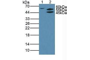 Figure. (AKT2 anticorps  (AA 142-412))