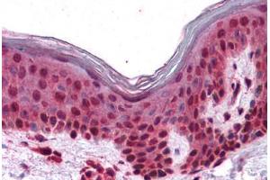 Human Skin: Formalin-Fixed, Paraffin-Embedded (FFPE)