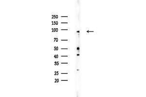Western blot analysis of lysates from EC304 cells, using BCAR3 Antibody at 1/1000 dilution.