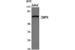 Western Blotting (WB) image for anti-Dystrophia Myotonica-Protein Kinase (DMPK) (N-Term) antibody (ABIN3174775) (DMPK anticorps  (N-Term))