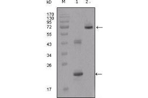 Western Blot showing IGFBP2 antibody used against truncated IGFBP2-His recombinant protein (1) and truncated IGFBP2 (aa40-328)-hIgGFc transfected CHO-K1 cell lysate (2). (IGFBP2 anticorps  (AA 180-328))