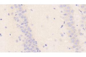 Detection of NOS1AP in Mouse Cerebellum Tissue using Polyclonal Antibody to Nitric Oxide Synthase 1 Adaptor Protein (NOS1AP) (NOS1AP anticorps  (AA 19-251))