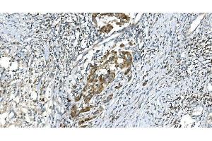 IHC analysis of DR6/TNFRSF21 using anti-DR6/TNFRSF21 antibody (ABIN7603008).