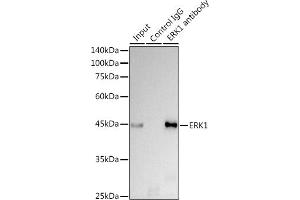 Immunoprecipitation analysis of 300 μg extracts of HeLa cells using 3 μg ERK1 antibody .