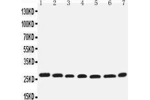 Western Blotting (WB) image for anti-Eukaryotic Translation Initiation Factor 6 (EIF6) (AA 82-96), (Middle Region) antibody (ABIN3044059) (EIF6 anticorps  (Middle Region))