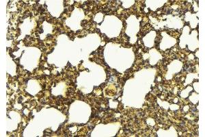 ABIN6276873 at 1/100 staining Mouse lung tissue by IHC-P.