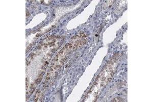 Immunohistochemical staining of human kidney with MYO18B polyclonal antibody  shows moderate cytoplasmic positivity in renal tubules. (MYO18B anticorps)