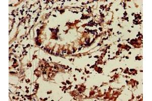 Immunohistochemistry of paraffin-embedded human appendix tissue using ABIN7172340 at dilution of 1:100 (TNIK anticorps  (AA 523-714))