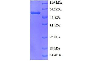 Carbonyl Reductase 1 (CBR1) (AA 2-277), (full length) protein (GST tag)