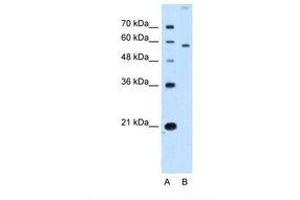 Image no. 1 for anti-Solute Carrier Family 22 (Organic Cation Transporter), Member 2 (SLC22A2) (N-Term) antibody (ABIN320833)
