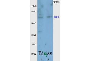 Rat brain lysates probed with Anti Nrf2 Polyclonal Antibody, Unconjugated (ABIN737271) at 1:200 overnight at 4 °C.