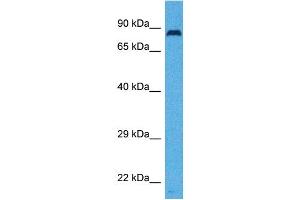 Host:  Rabbit  Target Name:  SLC26A4  Sample Tissue:  Human Ovary Tumor  Antibody Dilution:  1ug/ml (SLC26A4 anticorps  (Middle Region))