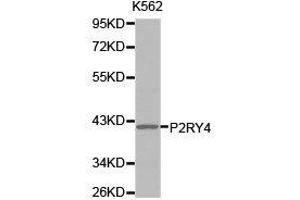 Western Blotting (WB) image for anti-Pyrimidinergic Receptor P2Y, G-Protein Coupled, 4 (P2RY4) antibody (ABIN1874015) (P2RY4 anticorps)