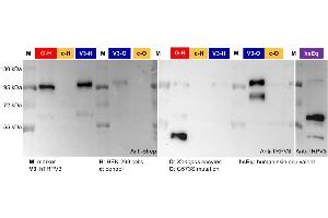 Detection of hTRPV3 in overexpressing HEK-293 cells, X.
