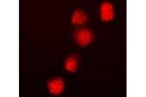 Immunofluorescent analysis of BRG1 staining in Hela cells. (SMARCA4 anticorps)