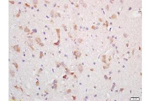 Formalin-fixed and paraffin embedded rat brain labeled with Rabbit Anti-MCHR Polyclonal Antibody, Unconjugated (ABIN719051) at 1:200 followed by conjugation to the secondary antibody and DAB staining (MCHR1 anticorps  (AA 75-180))