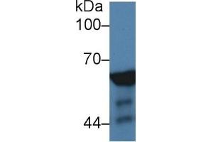 Detection of NUP62 in Human Raji cell lysate using Polyclonal Antibody to Nucleoporin 62 (NUP62)