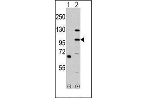 Image no. 1 for anti-Mitogen-Activated Protein Kinase Kinase Kinase MLK4 (KIAA1804) (N-Term) antibody (ABIN360429) (MLK4 anticorps  (N-Term))