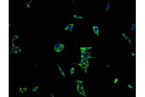 Immunofluorescence staining of MCF-7 cells with ABIN7167210 at 1:100, counter-stained with DAPI. (MRAS anticorps  (AA 1-205))