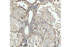 IHC analysis of ICAM1 using anti-ICAM1 antibody (ABIN5692991). (ICAM1 anticorps  (AA 28-268))