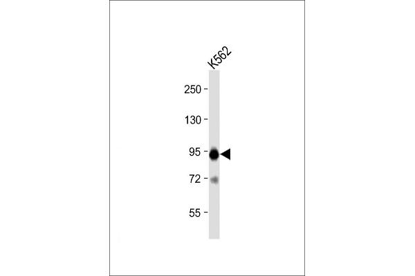 SNRPE Antikörper  (AA 424-453)