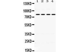 Western Blotting (WB) image for anti-Polymeric Immunoglobulin Receptor (PIGR) (AA 579-613), (C-Term) antibody (ABIN3043380) (PIGR anticorps  (C-Term))