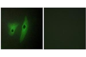 Immunofluorescence analysis of HeLa cells, using DUS19 antibody. (DUSP19 anticorps  (Internal Region))