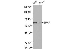 Western blot analysis of extracts of various cell lines, using BRAF antibody. (BRAF anticorps)