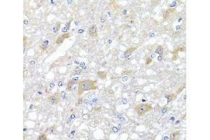Immunohistochemistry of paraffin-embedded Rat brain using INPP5K Polyclonal Antibody at dilution of 1:100 (40x lens).