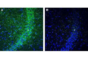 Expression of GPR160 in mouse hippocampus. (GPR160 anticorps  (Intracellular))