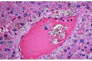 Human Liver: Formalin-Fixed, Paraffin-Embedded (FFPE)