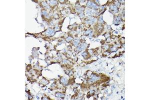 Immunohistochemistry of paraffin-embedded rat liver using SLC14 Rabbit pAb (5991) at dilution of 1:200 (40x lens). (SLC14A1 anticorps  (C-Term))