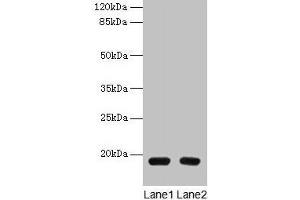 Western blot All lanes: PDE6D antibody at 1. (PDE6D anticorps  (AA 1-150))