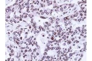 Immunohistochemistry: Lamin A/C antinbody staining of Paraffin-Embedded H441 Xenograft at 1/100 dilution. (Lamin A/C anticorps  (AA 59-249))