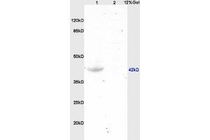 L1 human colon carcinoma, L2 mouse brain lysates probed (ABIN685717) at 1:200 in 4 °C.