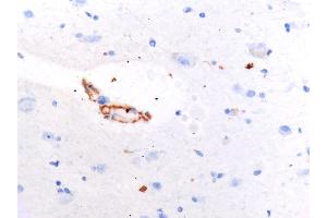 IHC Validation of SARS-CoV2 Spike in COVID-19 Patient Brain.