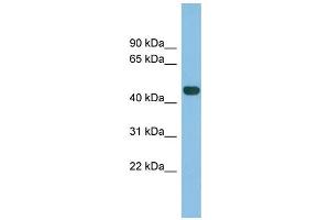 WB Suggested Anti-TFB2M Antibody Titration: 0. (TFB2M anticorps  (N-Term))