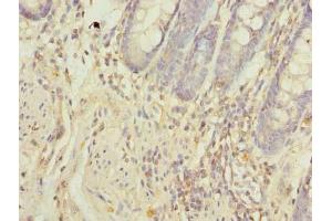 Immunohistochemistry of paraffin-embedded human colon tissue using ABIN7162093 at dilution of 1:100 (FAM55A anticorps  (AA 1-405))