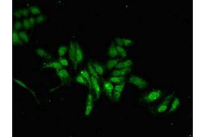 anti-Mab-21-Like 2 (MAB21L2) (AA 1-300) antibody
