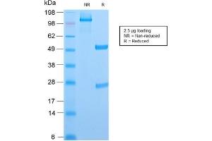 SDS-PAGE Analysis Purified CD6 Rabbit Recombinant Monoclonal Antibody (C6/2884R). (Recombinant CD6 anticorps)