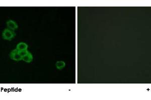 Immunofluorescence analysis of MCF-7 cells, using CAMK2A/CAMK2D polyclonal antibody . (CAMK2A anticorps)