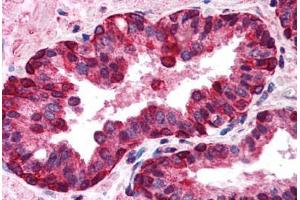 Human Prostate (formalin-fixed, paraffin-embedded) stained with IRF3 antibody ABIN213923 at 5-10 ug/ml followed by biotinylated goat anti-rabbit IgG secondary antibody ABIN481713, alkaline phosphatase-streptavidin and chromogen. (IRF3 anticorps  (C-Term))